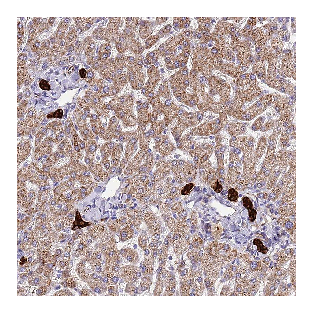 Atlas Antibodies Anti-ZDHHC1 Antibody