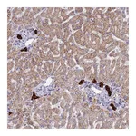 Atlas Antibodies Anti-ZDHHC1 Antibody