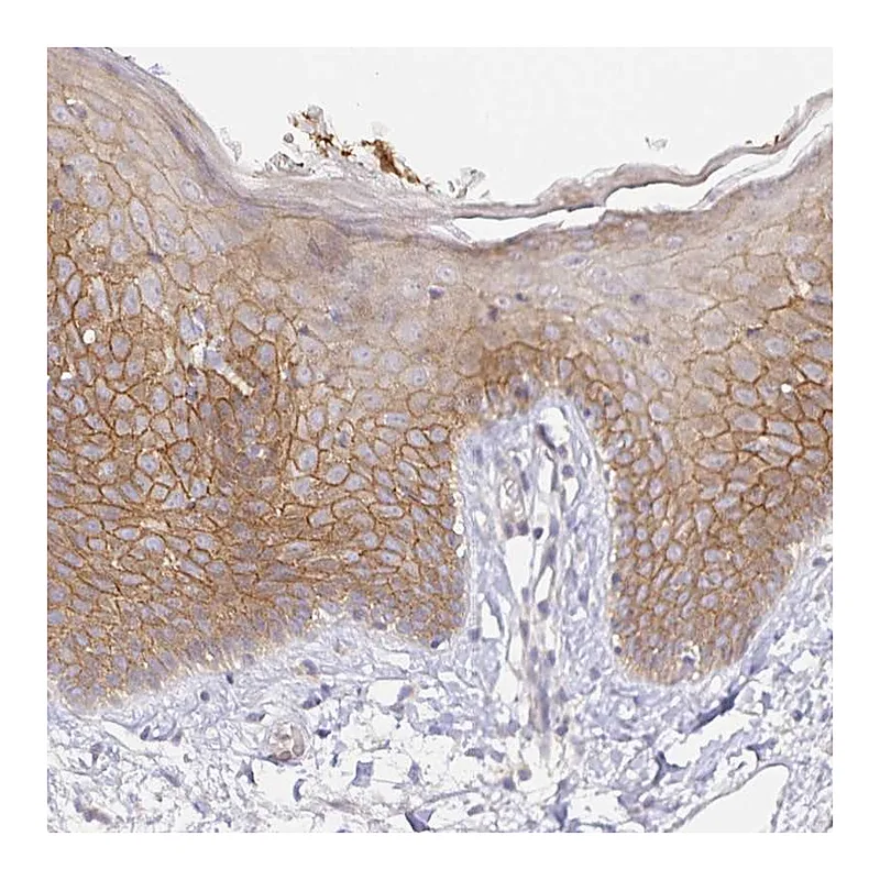 Atlas Antibodies Anti-ZDHHC11B Antibody