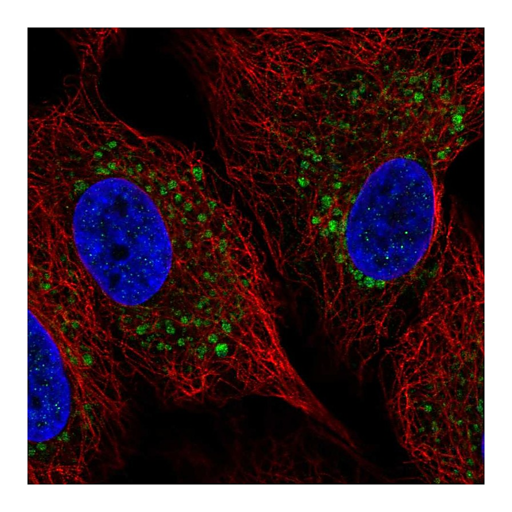 Atlas Antibodies Anti-ZDHHC11B Antibody