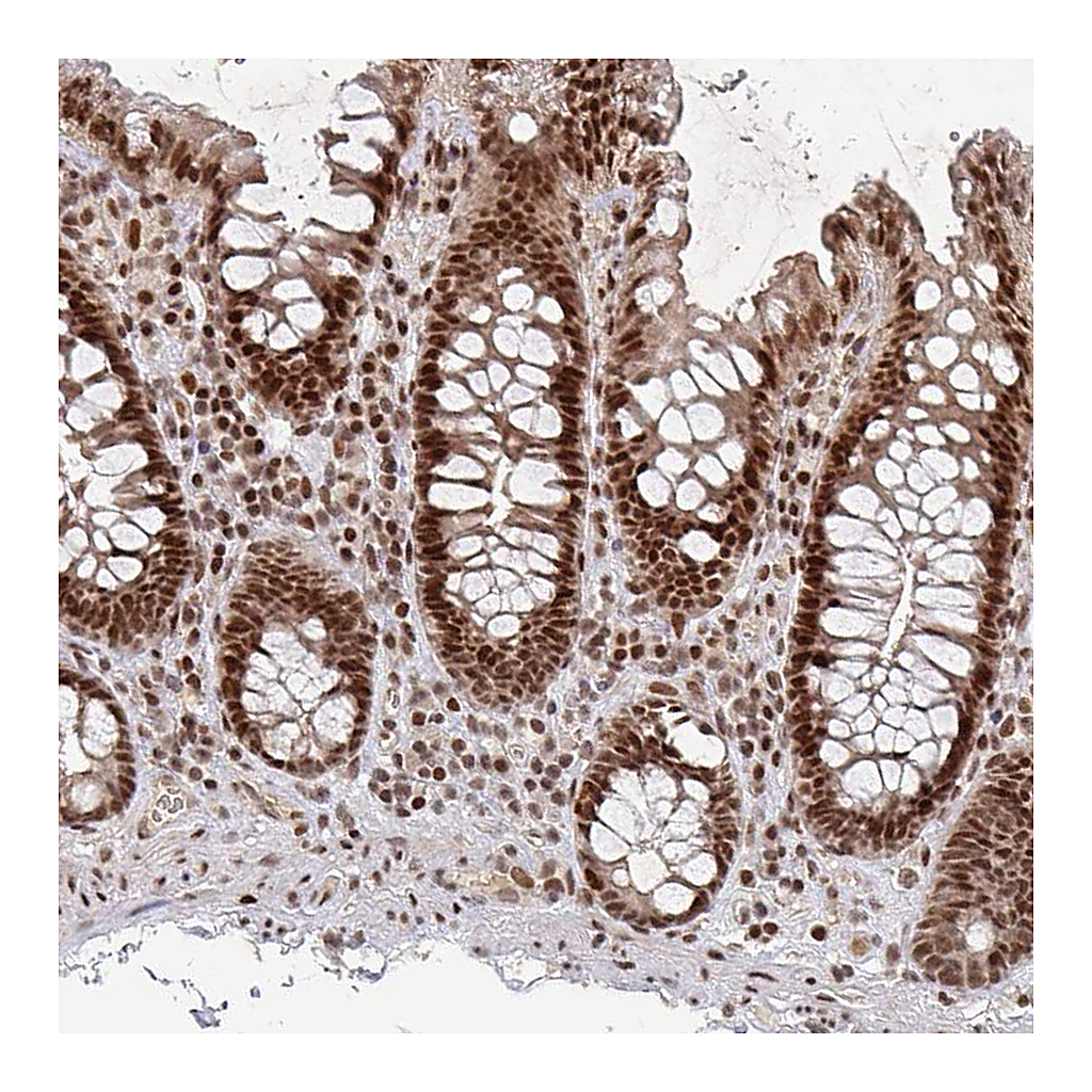 Atlas Antibodies Anti-ZDHHC12 Antibody