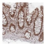 Atlas Antibodies Anti-ZDHHC12 Antibody