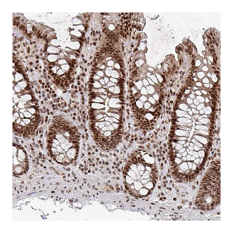 Atlas Antibodies Anti-ZDHHC12 Antibody
