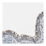 Atlas Antibodies Anti-ZDHHC13 Antibody