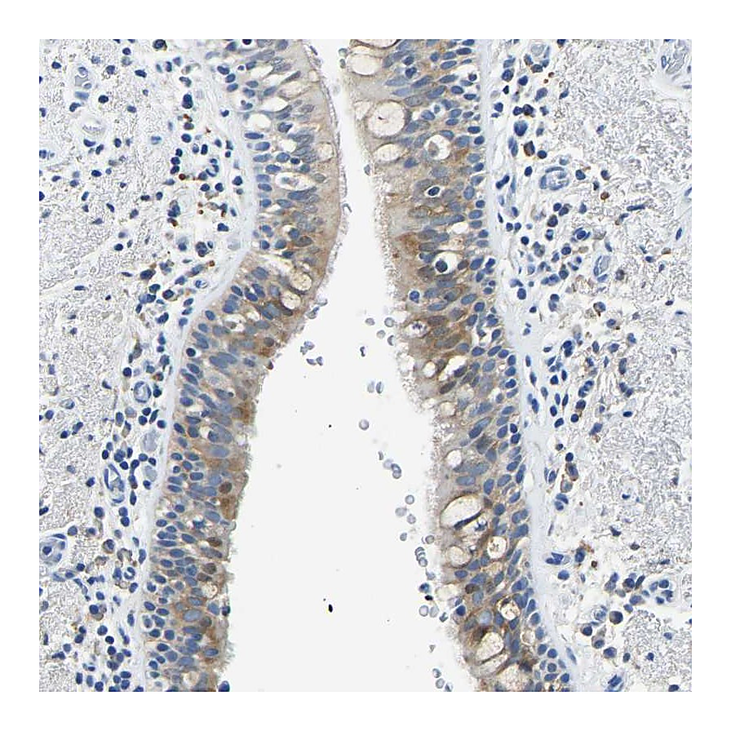 Atlas Antibodies Anti-ZDHHC13 Antibody