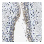 Atlas Antibodies Anti-ZDHHC13 Antibody