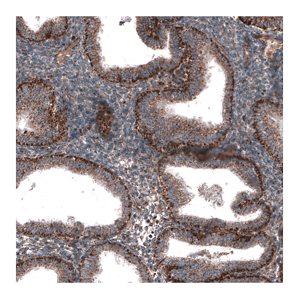 Atlas Antibodies Anti-ZDHHC14 Antibody