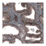Atlas Antibodies Anti-ZDHHC14 Antibody