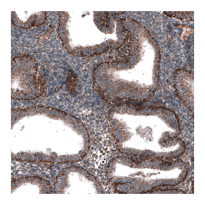 Atlas Antibodies Anti-ZDHHC14 Antibody