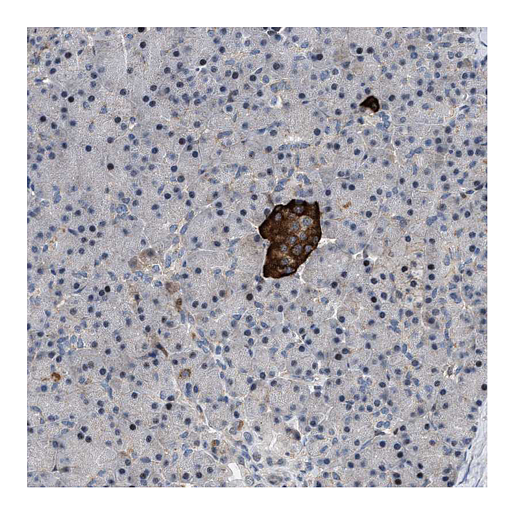 Atlas Antibodies Anti-ZDHHC15 Antibody