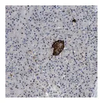 Atlas Antibodies Anti-ZDHHC15 Antibody