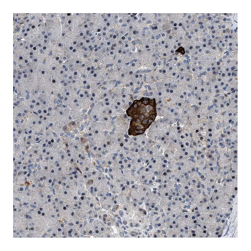 Atlas Antibodies Anti-ZDHHC15 Antibody