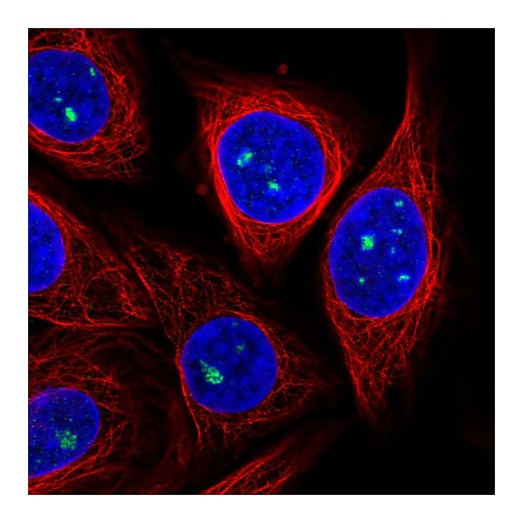 Atlas Antibodies Anti-ZDHHC14 Antibody