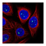 Atlas Antibodies Anti-ZDHHC14 Antibody