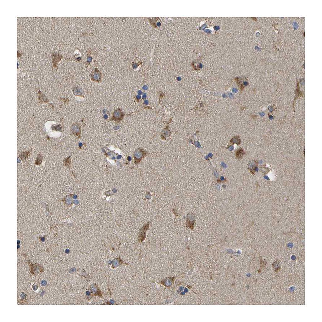 Atlas Antibodies Anti-ZDHHC17 Antibody