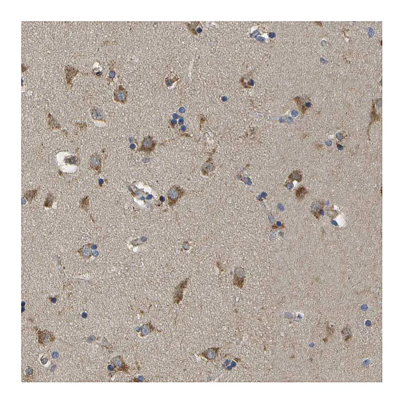 Atlas Antibodies Anti-ZDHHC17 Antibody