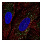 Atlas Antibodies Anti-ZDHHC17 Antibody