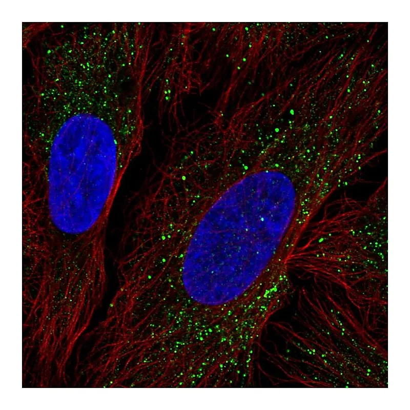 Atlas Antibodies Anti-ZDHHC17 Antibody