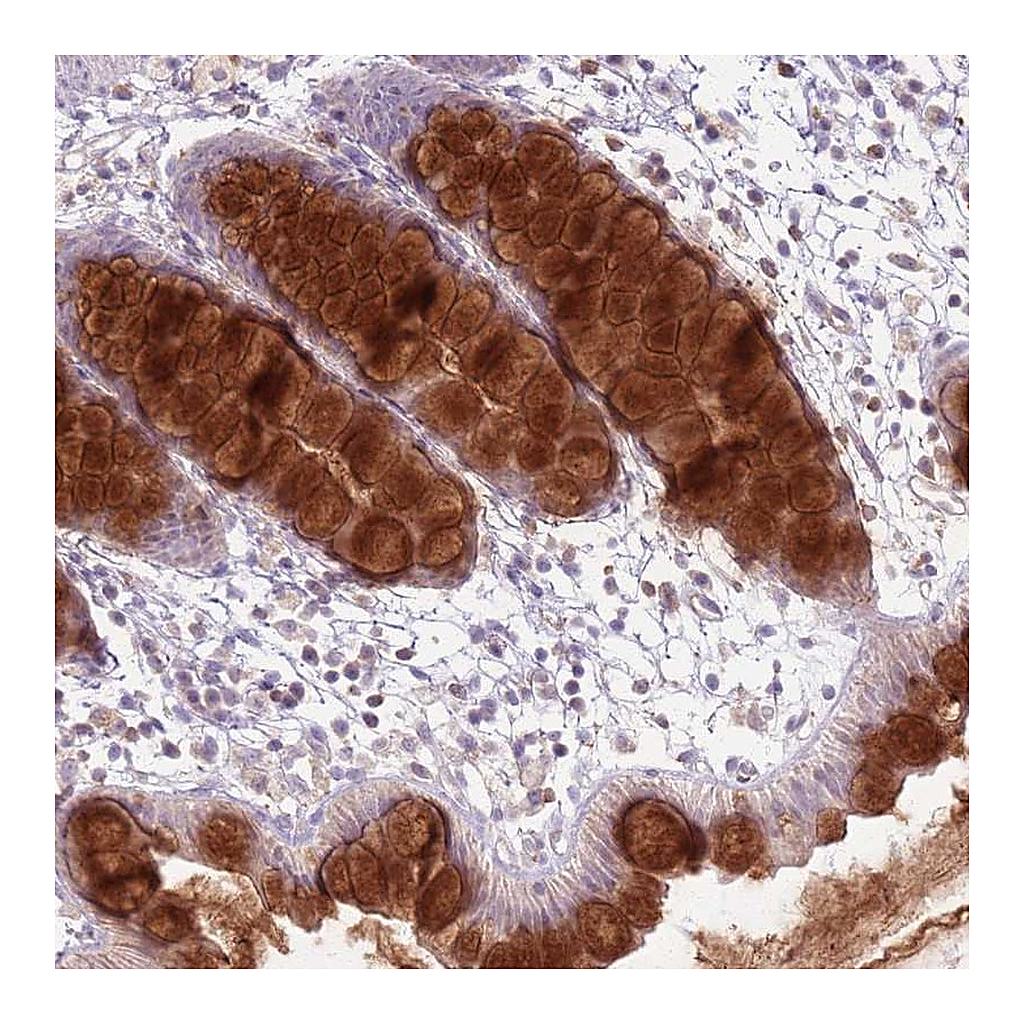 Atlas Antibodies Anti-ZDHHC2 Antibody