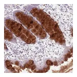 Atlas Antibodies Anti-ZDHHC2 Antibody