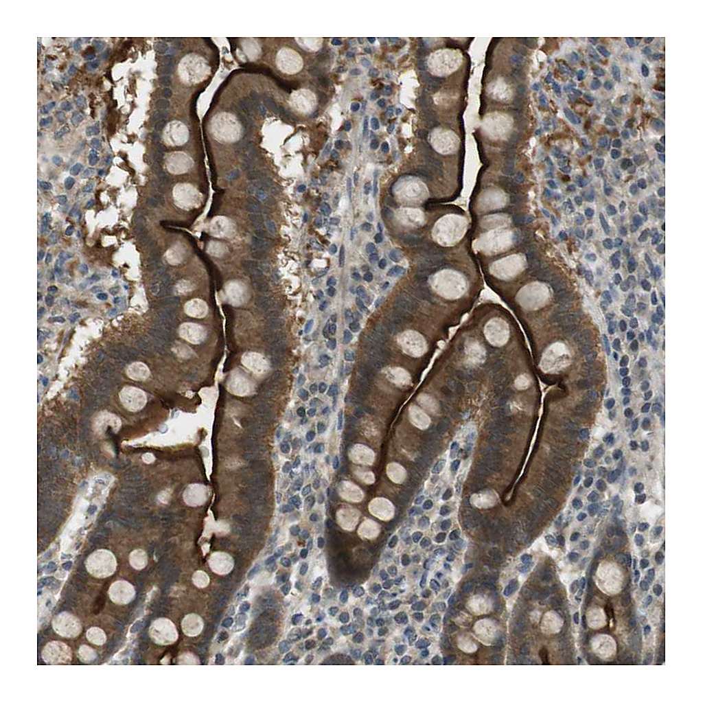 Atlas Antibodies Anti-ZDHHC20 Antibody