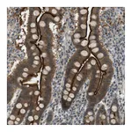 Atlas Antibodies Anti-ZDHHC20 Antibody