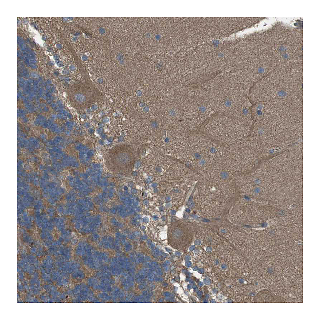 Atlas Antibodies Anti-ZDHHC20 Antibody