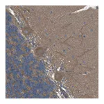 Atlas Antibodies Anti-ZDHHC20 Antibody