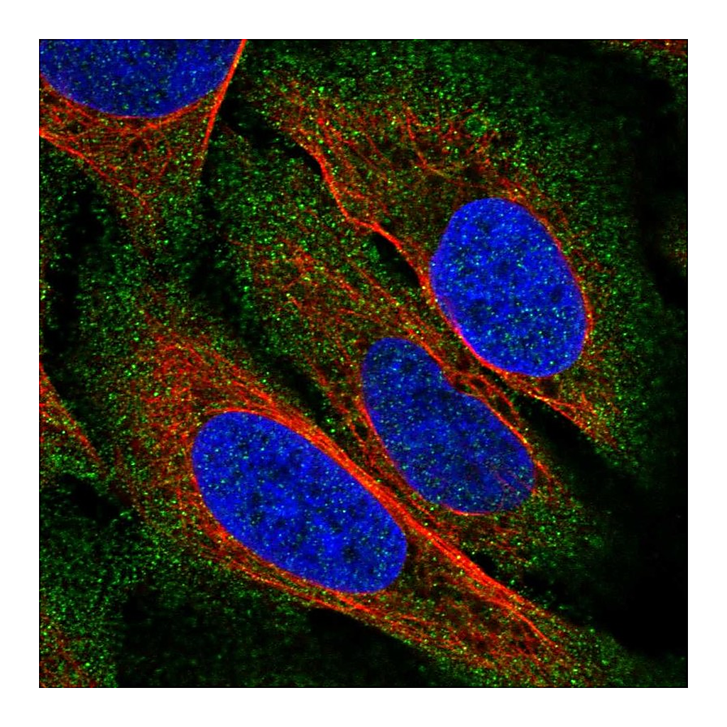 Atlas Antibodies Anti-ZDHHC22 Antibody