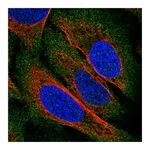 Atlas Antibodies Anti-ZDHHC22 Antibody