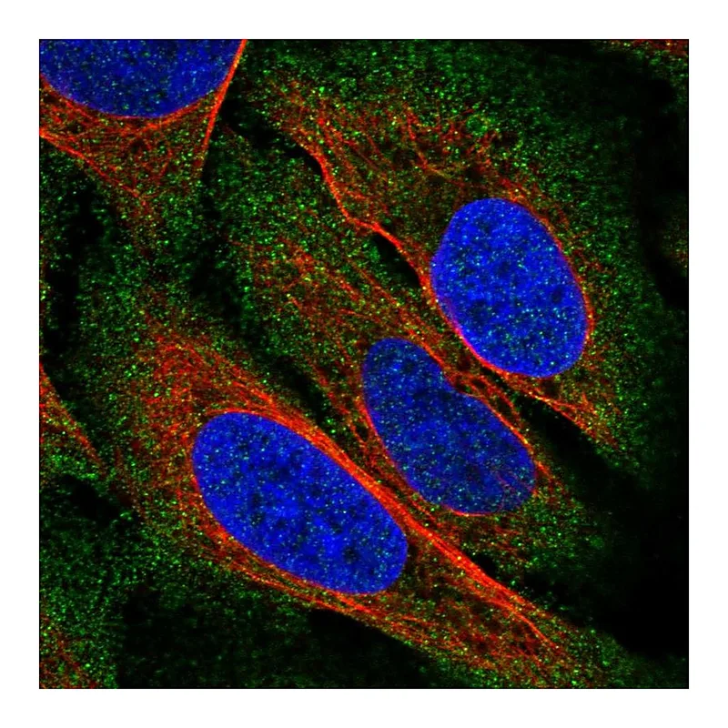 Atlas Antibodies Anti-ZDHHC22 Antibody