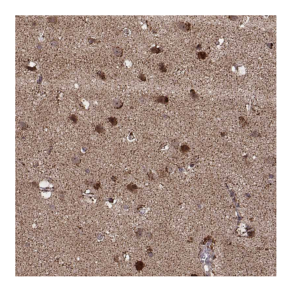 Atlas Antibodies Anti-ZDHHC21 Antibody