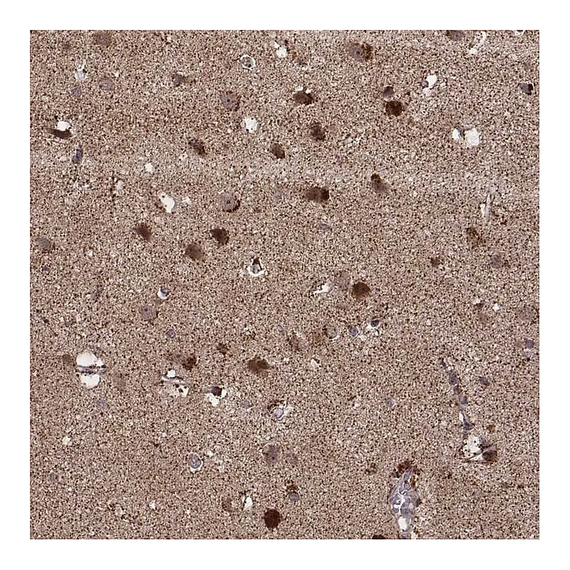 Atlas Antibodies Anti-ZDHHC21 Antibody