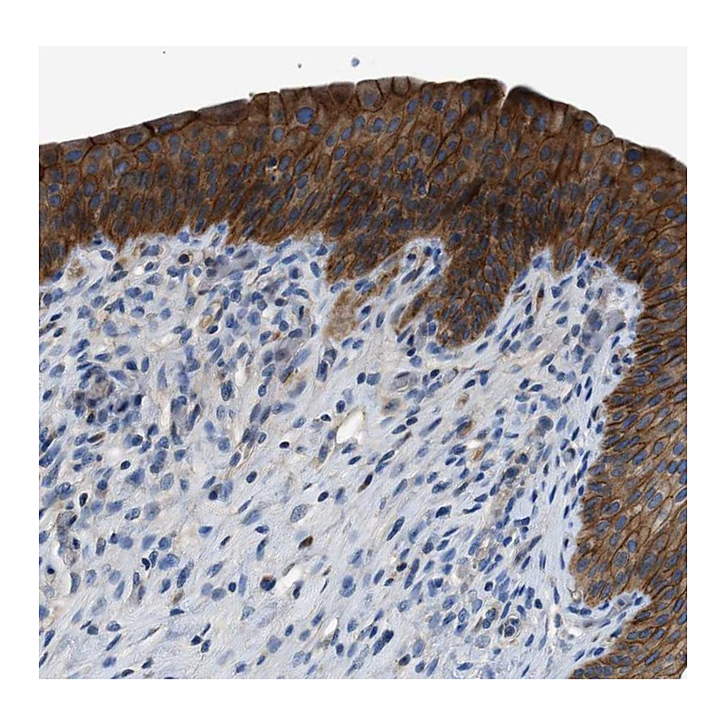 Atlas Antibodies Anti-ZDHHC24 Antibody