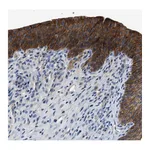 Atlas Antibodies Anti-ZDHHC24 Antibody
