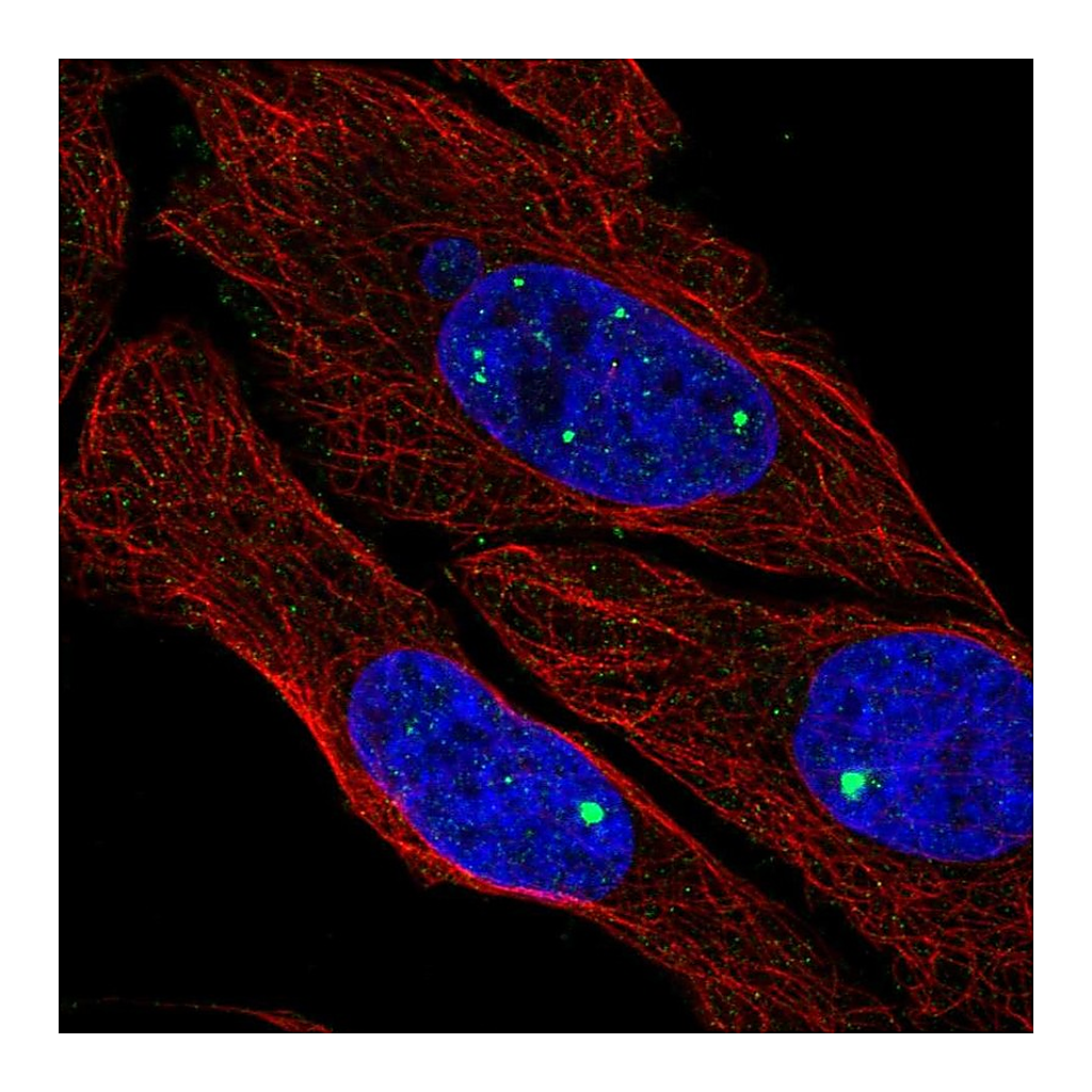 Atlas Antibodies Anti-ZDHHC4 Antibody
