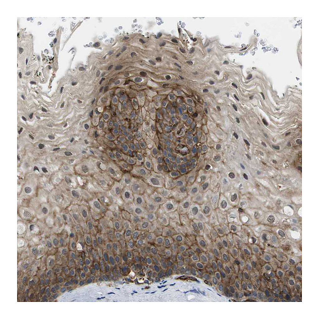Atlas Antibodies Anti-ZDHHC5 Antibody