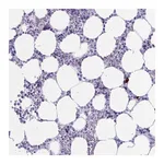 Atlas Antibodies Anti-ZDHHC7 Antibody