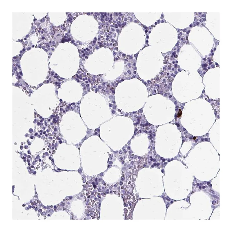 Atlas Antibodies Anti-ZDHHC7 Antibody