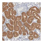 Atlas Antibodies Anti-ZDHHC8 Antibody