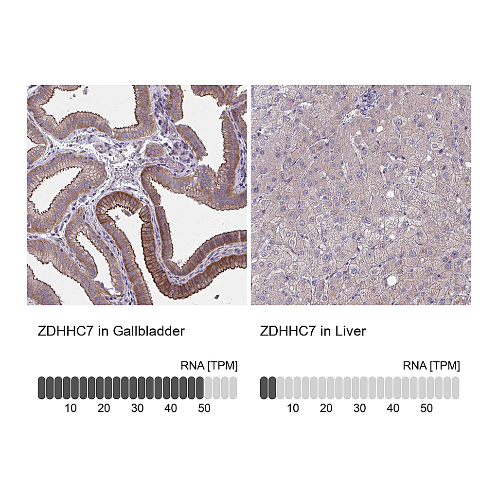 Atlas Antibodies Anti-ZDHHC7 Antibody