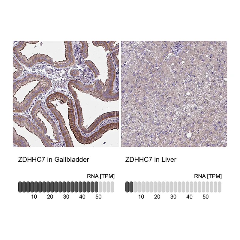 Atlas Antibodies Anti-ZDHHC7 Antibody