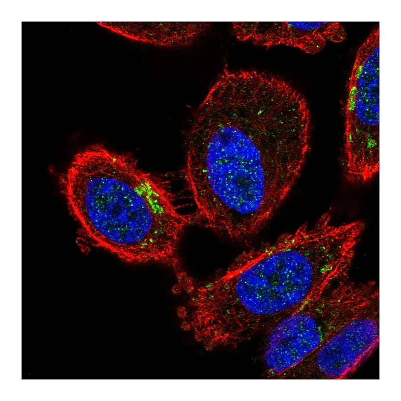 Atlas Antibodies Anti-ZDHHC7 Antibody