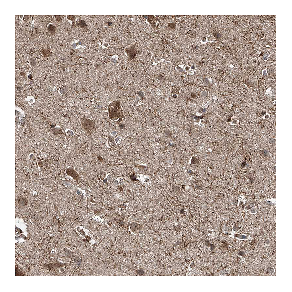 Atlas Antibodies Anti-ZDHHC9 Antibody