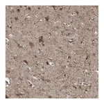 Atlas Antibodies Anti-ZDHHC9 Antibody