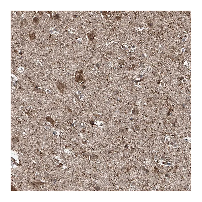 Atlas Antibodies Anti-ZDHHC9 Antibody