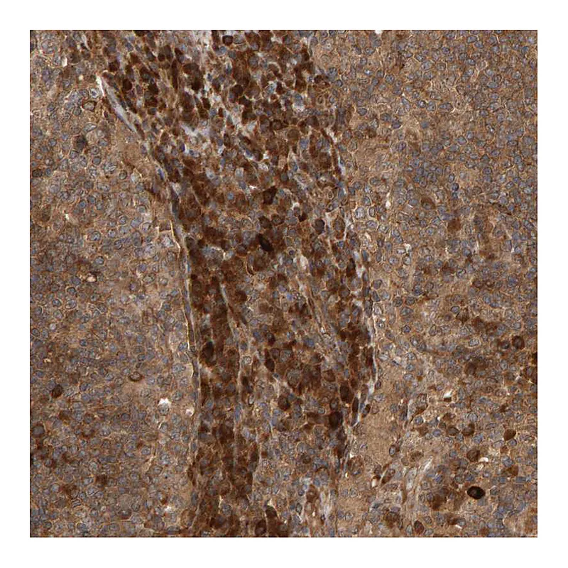 Atlas Antibodies Anti-ZFAND1 Antibody