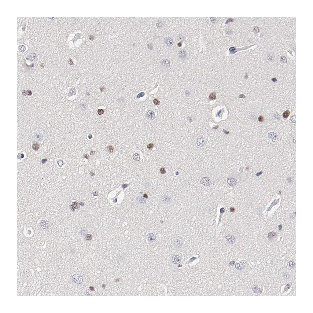 Atlas Antibodies Anti-ZEB2 Antibody