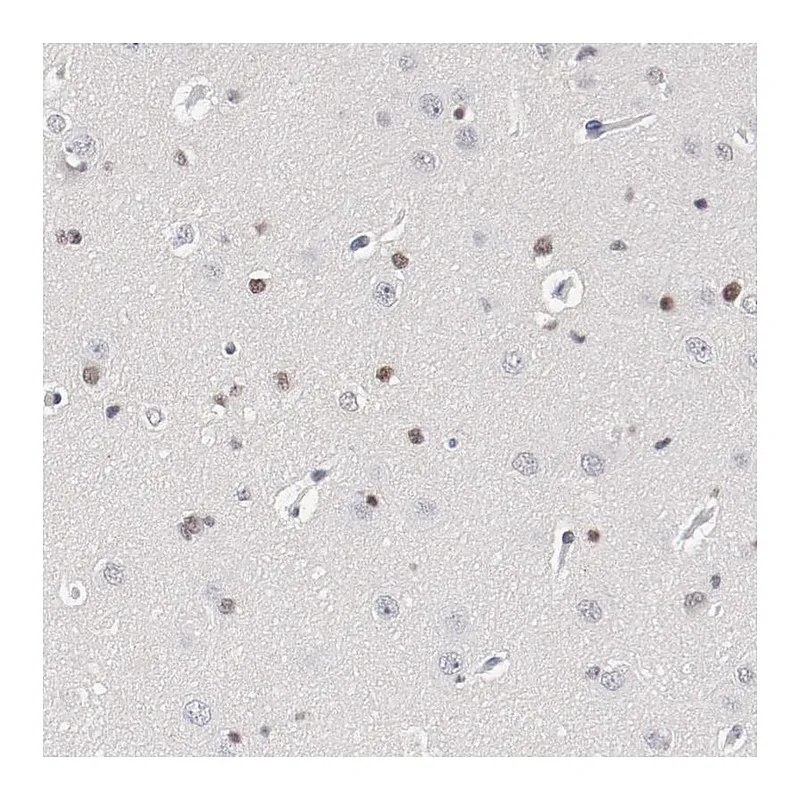 Atlas Antibodies Anti-ZEB2 Antibody
