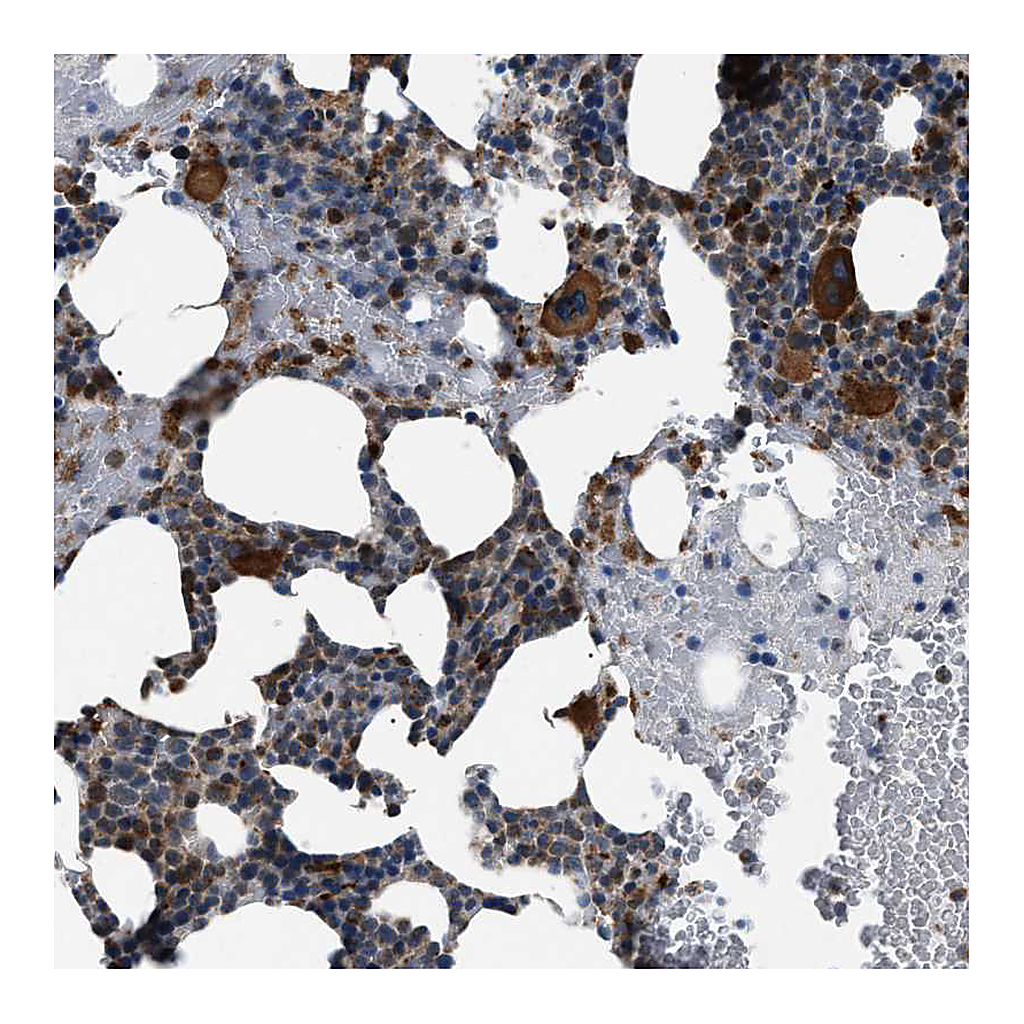 Atlas Antibodies Anti-ZFAND2A Antibody